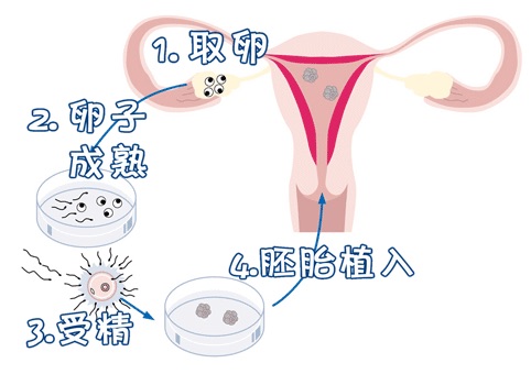 供卵试管选性别代生公司